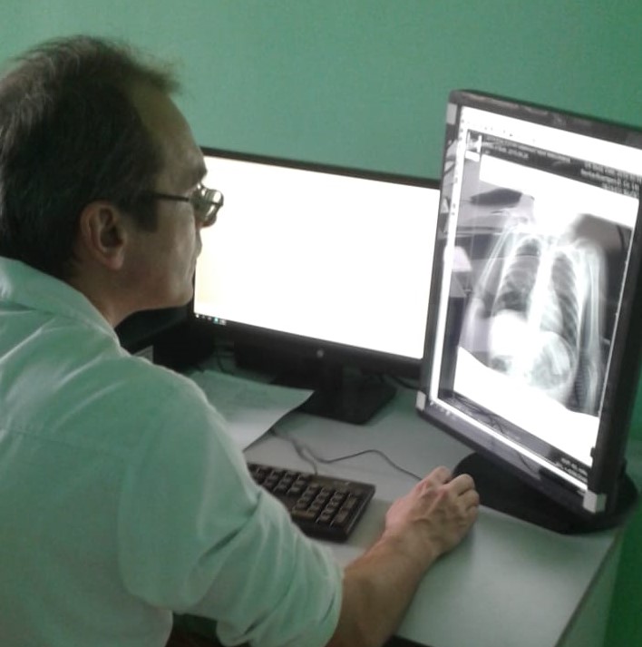 В Березовской ЦГБ для детей начал работать новый  рентгеновский диагностический комплекс